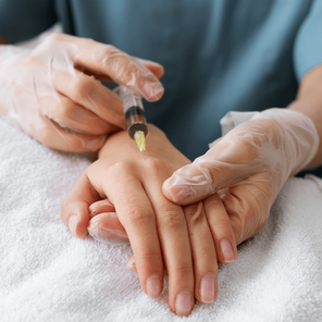 Плазмолифтинг кожи рук